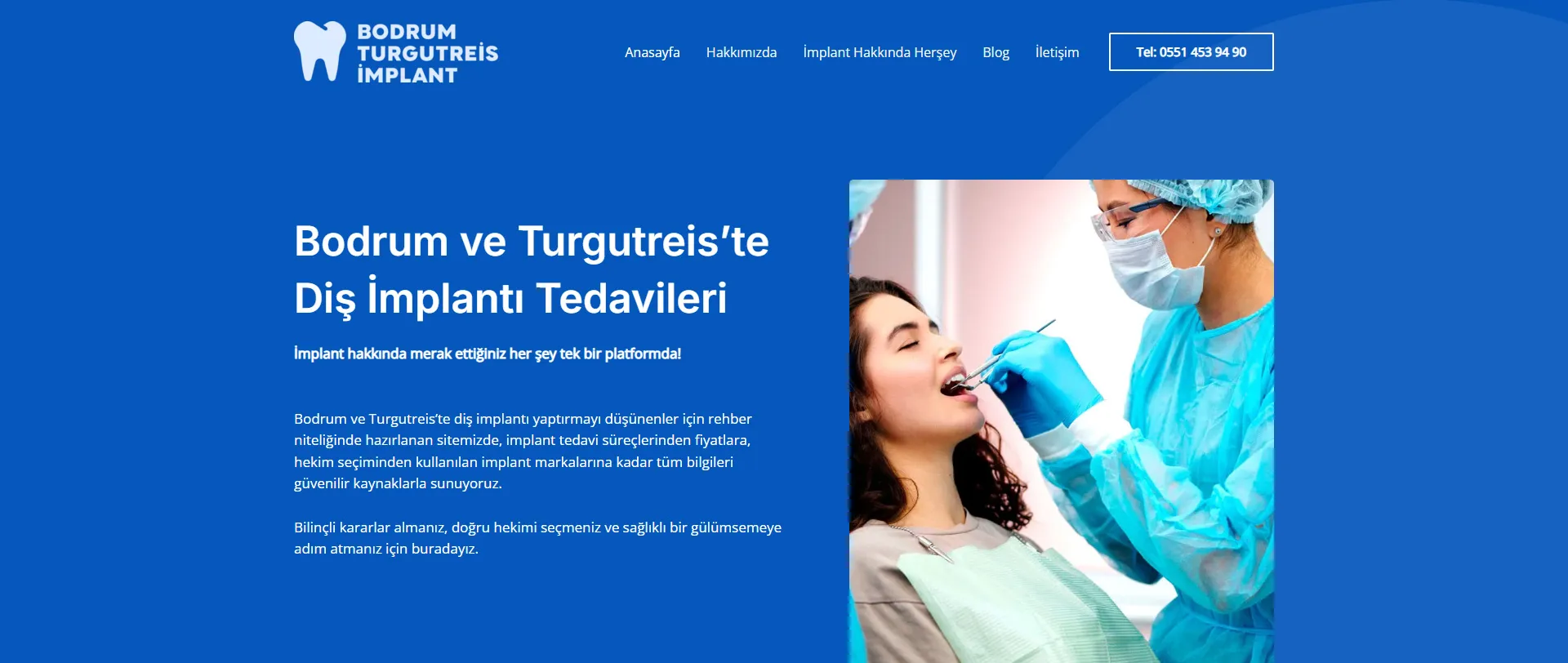 Bodrum Turgutreis Diş İmplant Web Projesi